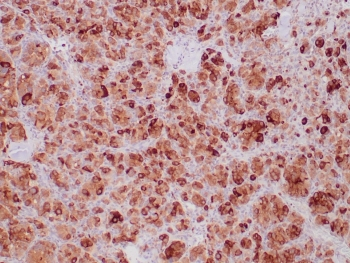 Recombinant SDHB Antibody