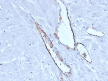 von Willebrand Factor Antibody / vWF