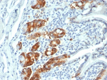 RRM1 Antibody / Ribonucleotide Reductase M1
