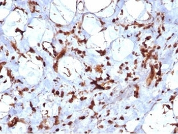 Recombinant STAT6 Antibody