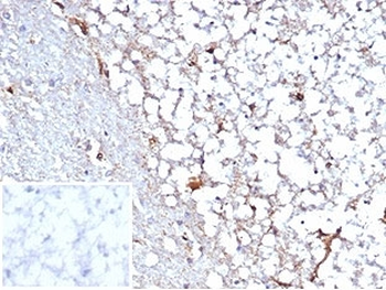 Recombinant STAT6 Antibody