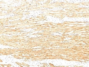 Recombinant Smoothelin Antibody / SMSMO / SMTN
