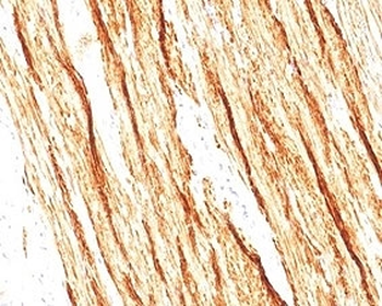 Recombinant Smoothelin Antibody / SMSMO / SMTN