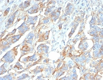 CD276 Antibody / B7-H3
