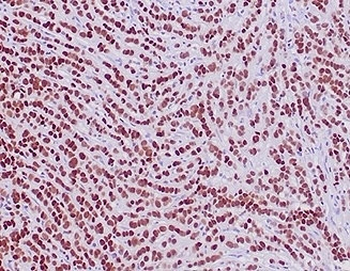 Recombinant GATA Binding Protein 3 Antibody / GATA-3