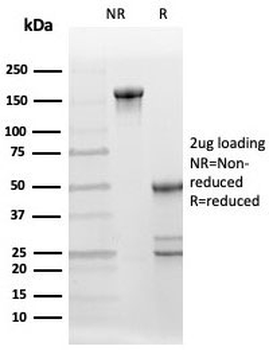 BCL-6 corepressor Antibody / BCOR