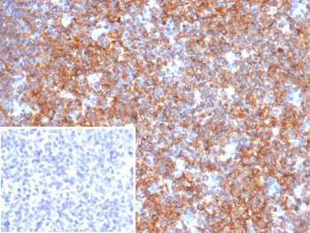 BCL-6 corepressor Antibody / BCOR