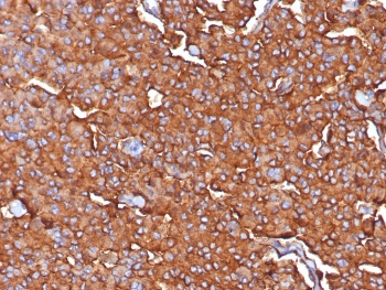 Synaptophysin Antibody / SYP