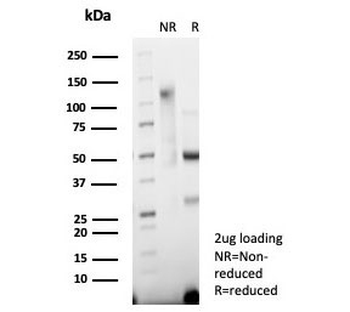 Synaptophysin Antibody / SYP