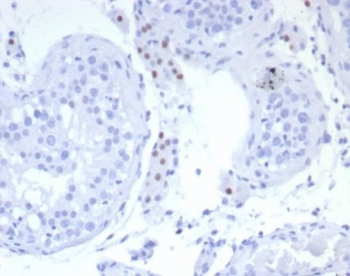SF-1 Antibody / Steroidogenic Factor 1 / NR5A1