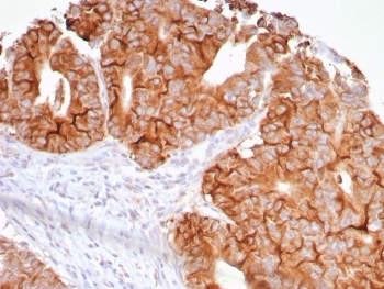 TNFSF15 Antibody / VEGI / TL1A