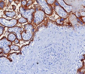 Programmed cell death 1 ligand 1 Antibody / PDL1 / CD274 / B7-H1