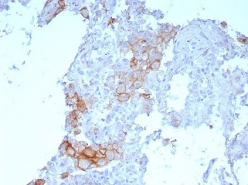 Programmed cell death 1 ligand 1 Antibody / PDL1 / CD274 / B7-H1