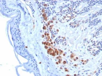 Tyrosinase-Related Protein-1 Antibody / TYRP1