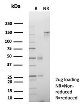 Cadherin 17 Antibody / CDH17