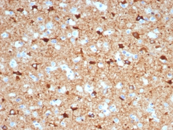 NECAB1 Antibody / N-terminal EF-hand calcium binding protein 1
