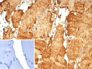 Carbonic Anhydrase 3 Antibody / CA3