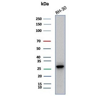 Carbonic Anhydrase 3 Antibody / CA3