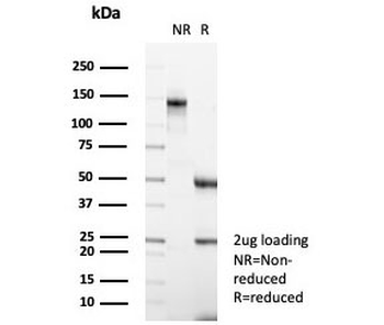 Carbonic Anhydrase 3 Antibody / CA3