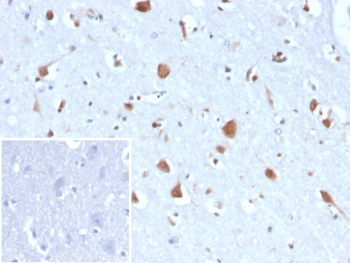 Carbonic Anhydrase VIII Antibody / CA8