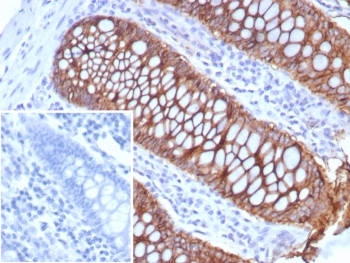 LI Cadherin Antibody / Cadherin 17