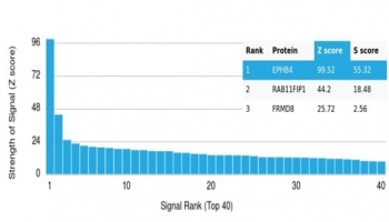 EPH Receptor B4 Antibody / EPHB4