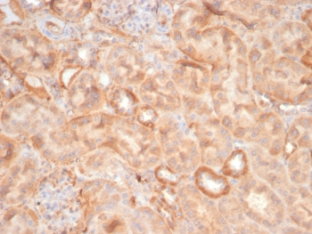 EPH Receptor B4 Antibody / EPHB4