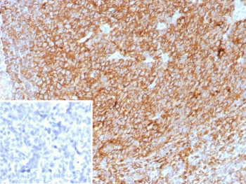HLA-DP/DQ/DR Antibody / Pan-HLA