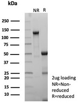 HLA-DP/DQ/DR Antibody / Pan-HLA