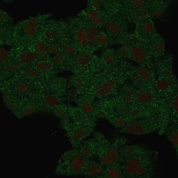 HSP90 beta Antibody / HSP90AB1