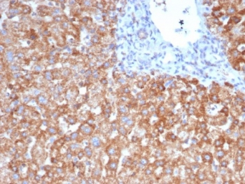 VEGF Antibody / Vascular Endothelial Growth Factor