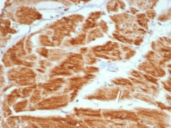VEGF Antibody / Vascular Endothelial Growth Factor