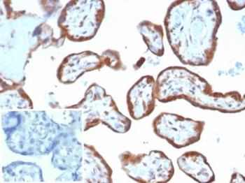 VEGF Antibody / Vascular Endothelial Growth Factor