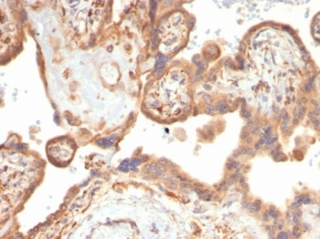 Vascular Endothelial Growth Factor Antibody / VEGF