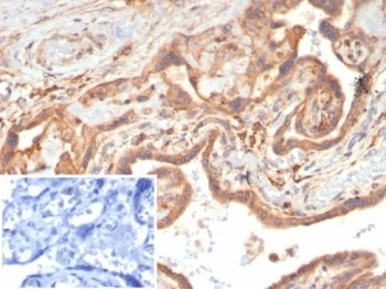 Vascular Endothelial Growth Factor Antibody / VEGF