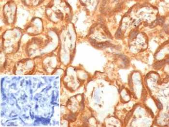 Vascular Endothelial Growth Factor Antibody / VEGF
