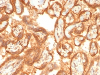 Vascular Endothelial Growth Factor Antibody / VEGF