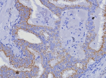 AMACR / p504S Antibody