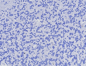 AMACR / p504S Antibody