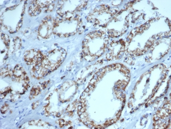 p504S Antibody / AMACR