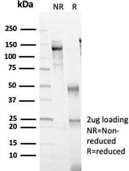 p504S Antibody / AMACR