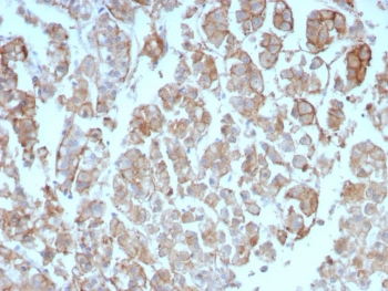 Interleukin-2 Antibody / IL-2