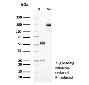 Interleukin-2 Antibody / IL-2