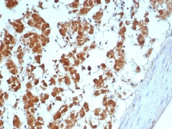 Interleukin-2 Antibody / IL-2
