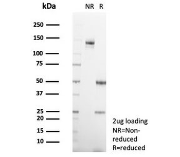 Interleukin-2 Antibody / IL-2