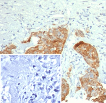 S100P Antibody / MIG9