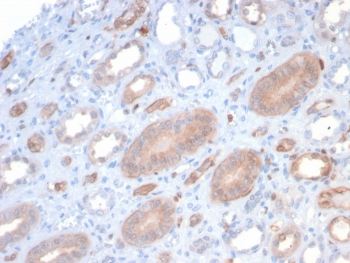 S100P Antibody