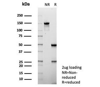 S100P Antibody