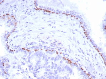 p40 Antibody / deltaNp63