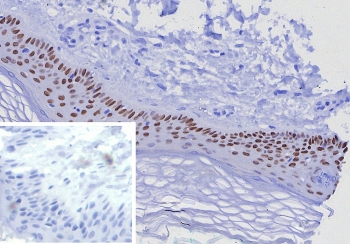 TP63 Antibody / Tumor protein 63 / p63